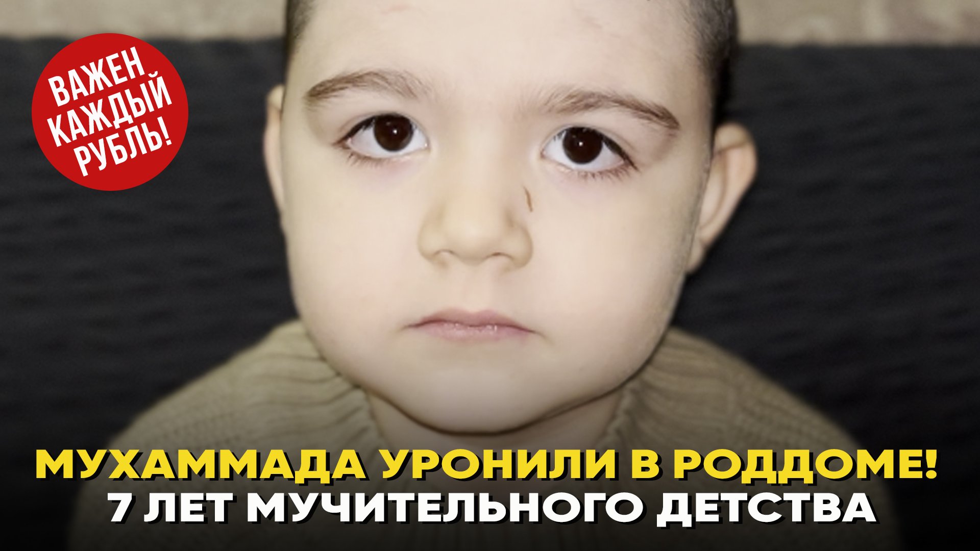 Мухаммада уронили в роддоме! 7 лет мучительного детства