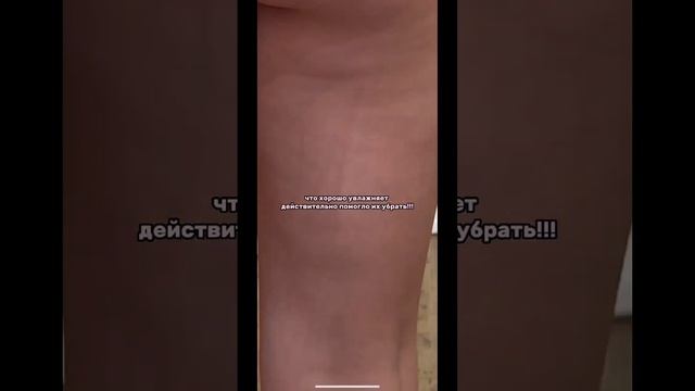 Как я убрала прыщи на теле? артикул: 119899275