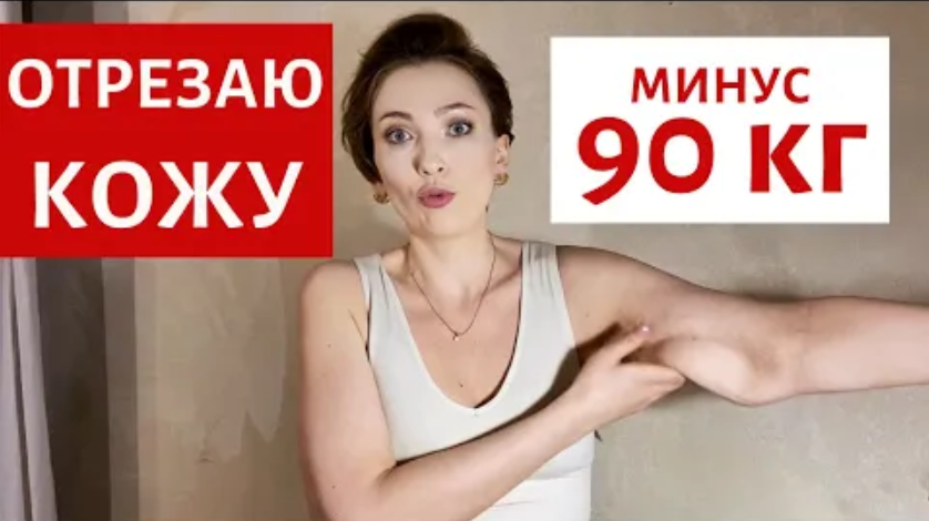 Я БОЮСЬ ПОДТЯЖКИ| УЖАСНОЕ ТЕЛО | АБДОМИНОПЛАСТИКА И БРАХИОПЛАСТИКА | ШВЫ