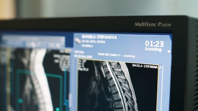 Нов ядрено-магнитен резонанс в ДКЦ "Авис Медика" - Плевен