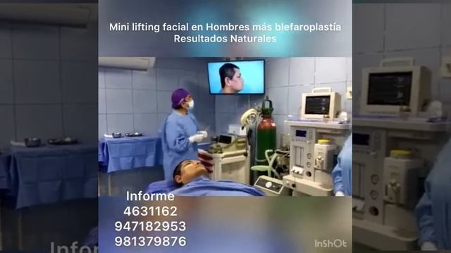 Mini lifting facial en Hombres más blefaroplastía