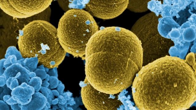 БИОФИЛЬТРАЦИЯ . ЧТО ТАКОЕ ? БАКТЕРИИ . BIOFILTRATION . WHAT IS IT? BACTERIA .