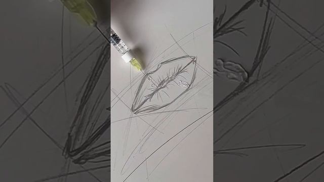 Увеличение губ