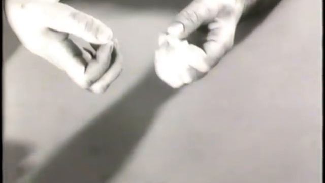 Полинейропатический синдром ©  Polyneuropathic Syndrome