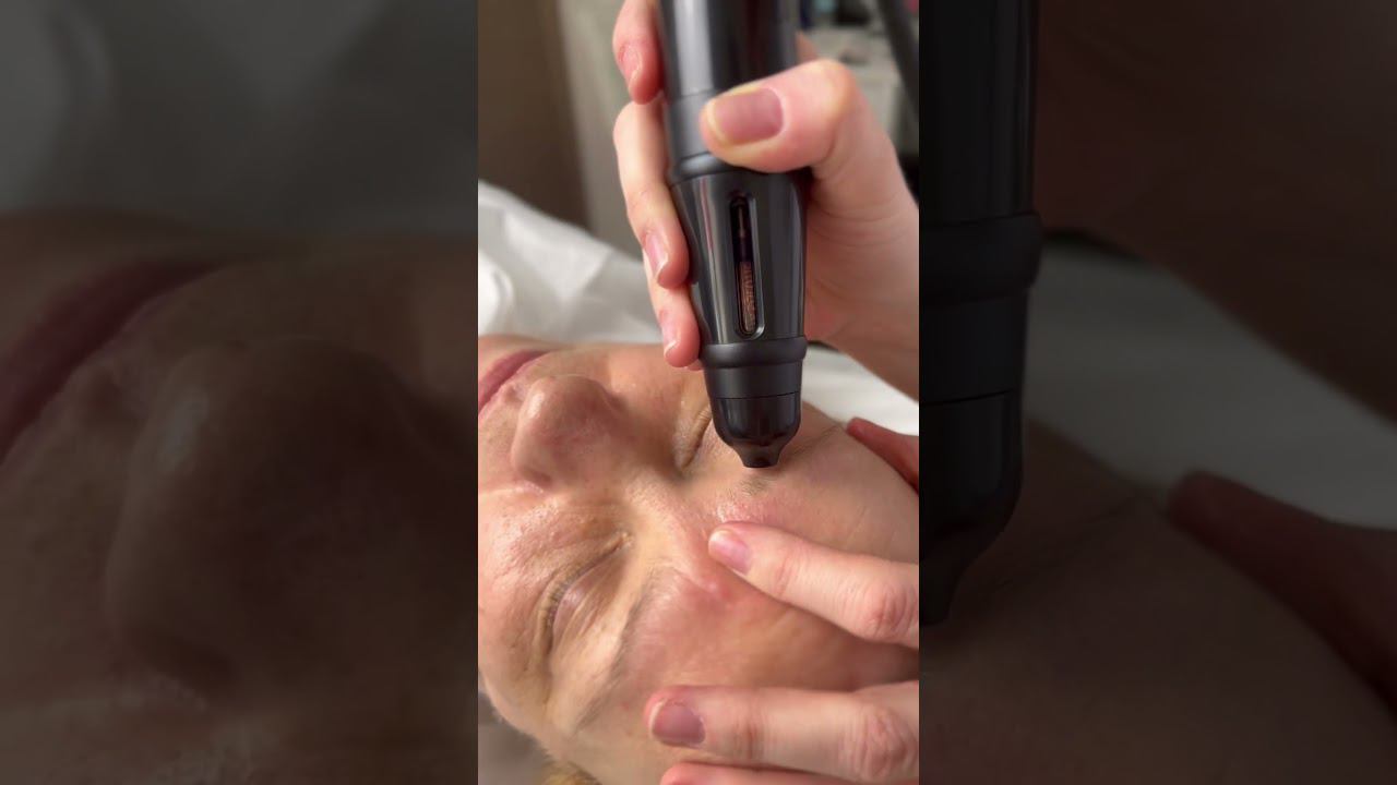 INSCALP - аппаратный ANTI-AGE для волос
