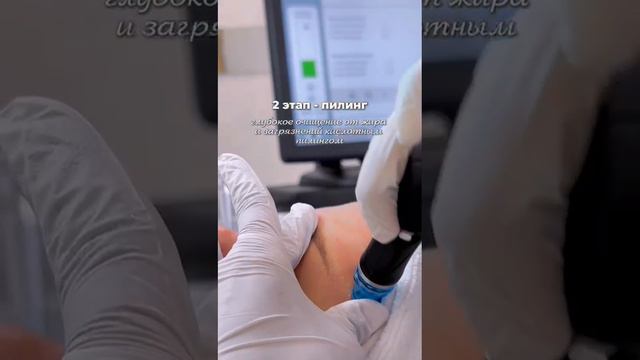 Голливудская процедура в Уфе