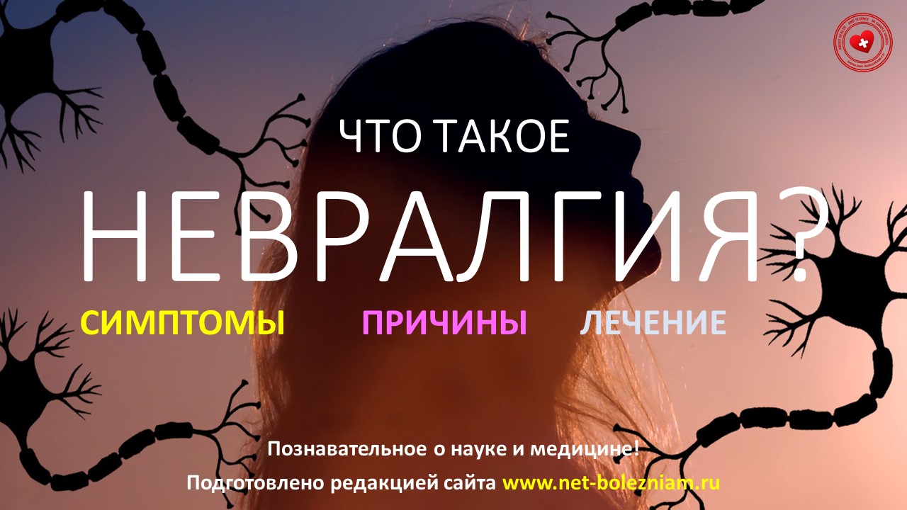 Что такое невралгия? Симптомы, причины и лечение болезни