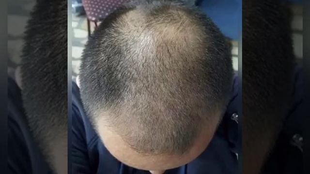 Extra Hair Yeşil Serumu saçlarınızın