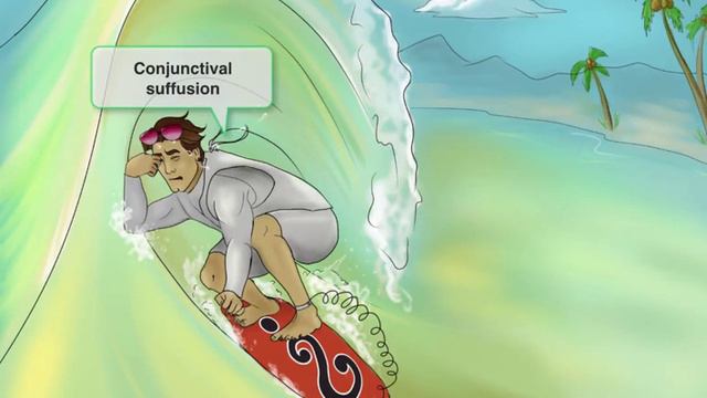 118 — Leptospirosis