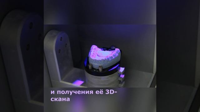 Сканирование гипсовой модели с помощью внеротового сканера