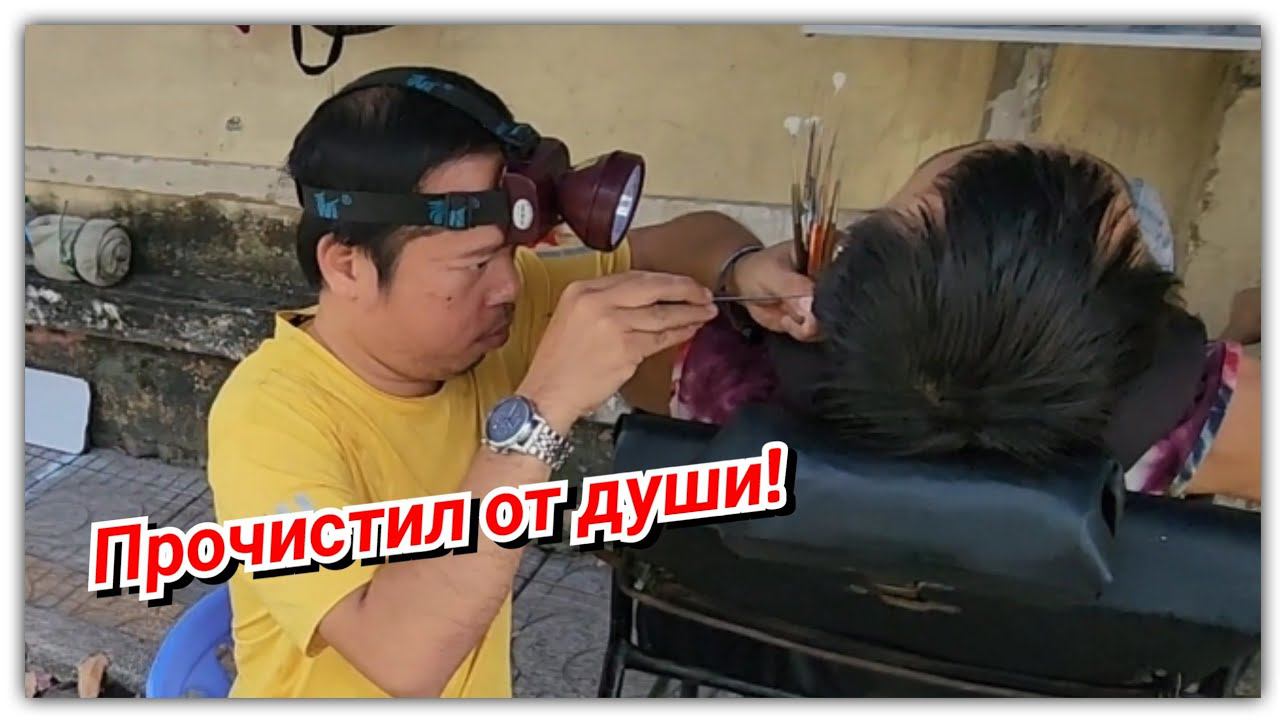 #163 Если тратить, то по-крупному! Экстремальная чистка ушей!