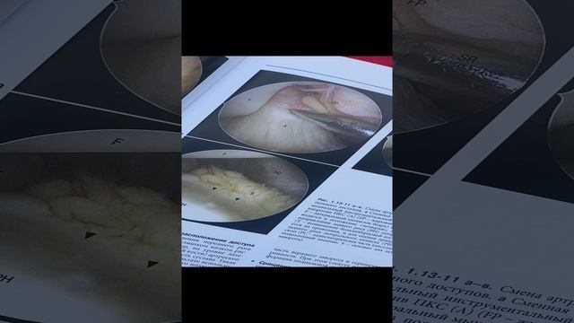 Руководство по артроскопической хирургии. Том 1