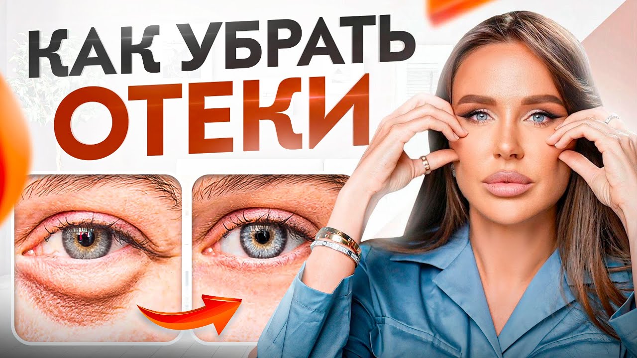 ОТЕКИ всегда имеют причину! Как избавиться от отеков?