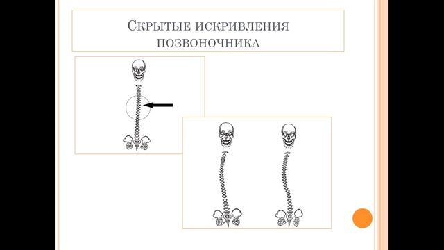 Сергей Ли ЗДОРОВАЯ СПИНА БЕЗ ТАБЛЕТОК