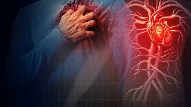 Как по внешним признакам можно понять что возникли сосудистые проблемы которые грозят катастрофами