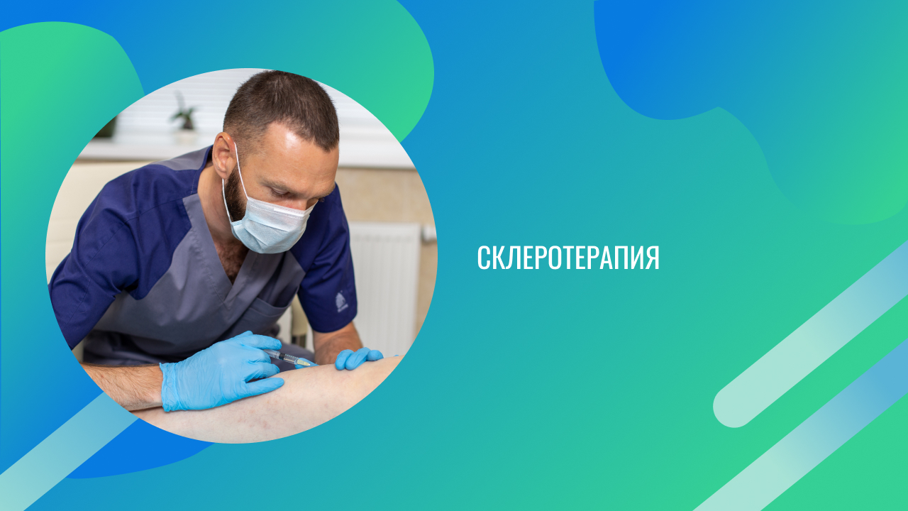 Склеротерапия