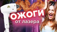 Ожоги в лазерной эпиляции, в чем причины? Жуткие последствия лазерной эпиляции #эпиляция #лазер