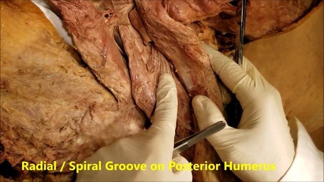 TRICEPS MUSCLE RADIAL NERVE Parts Relations And Clinical Aspects – Sanjoy Sanyal