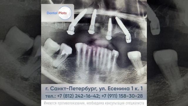 Прямиком из Камчатки! Еще один клинический случай.