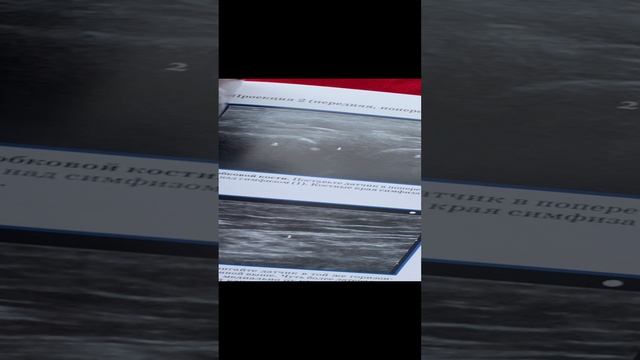 Учебник ультразвуковых исследований костно-мышечной системы