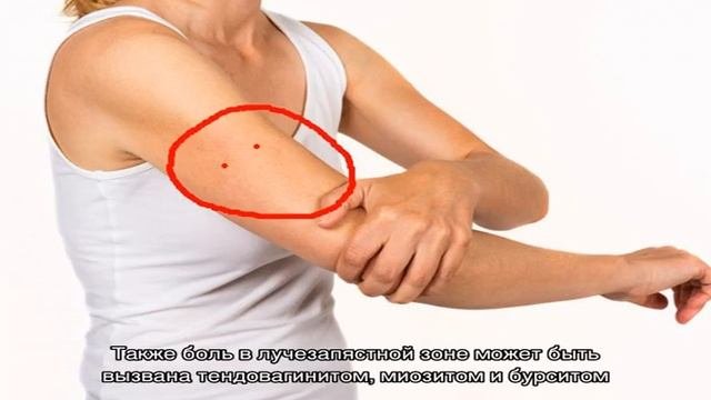 Боли в руках от плеча до кисти