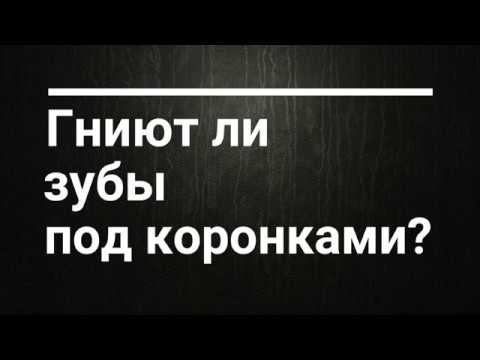 Разговор со стоматологом. Часть 1. Мифы.