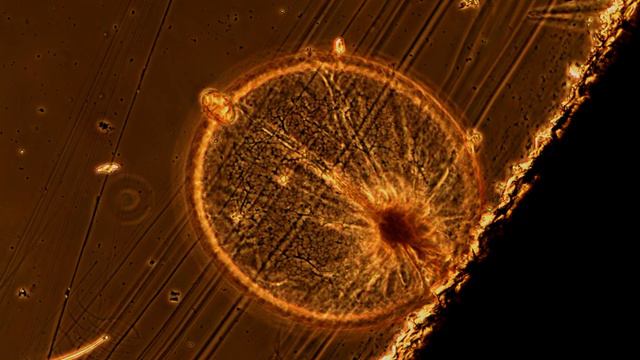 Noctiluca under the Microscope