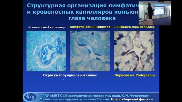 «Лимфатические структуры глаза и их возможная роль в механизмах развития первичной открытоугольной