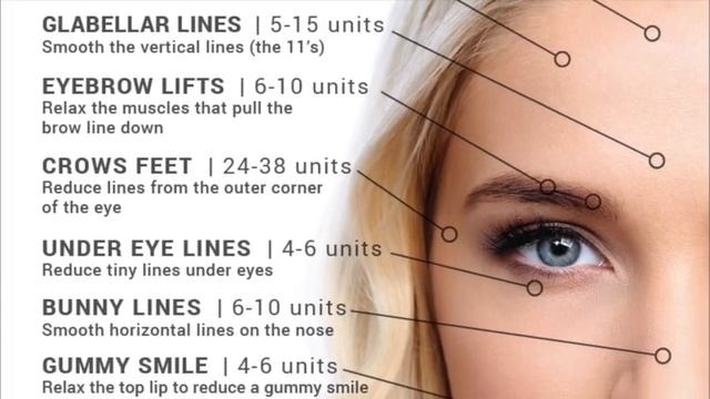 How Much Botox do you Need?