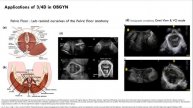BASICS OF 3D & 4D ULTRASOUND ACQUISITION.