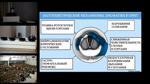 Реабилитация глотания  Авдюнина