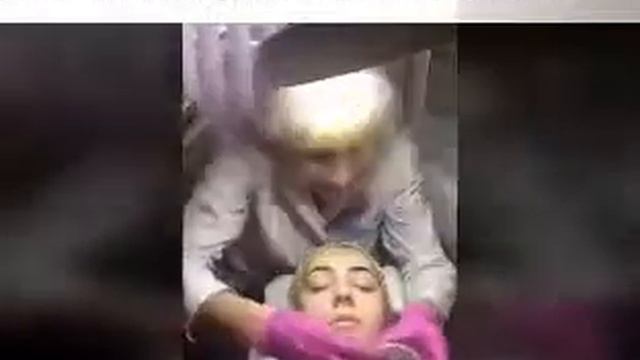Пилинг ГЛИКОЛЕВЫЙ с хитозаном