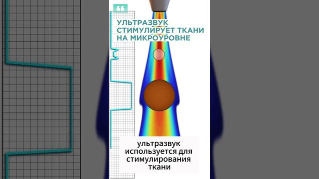 Аппарат Ретон Форте