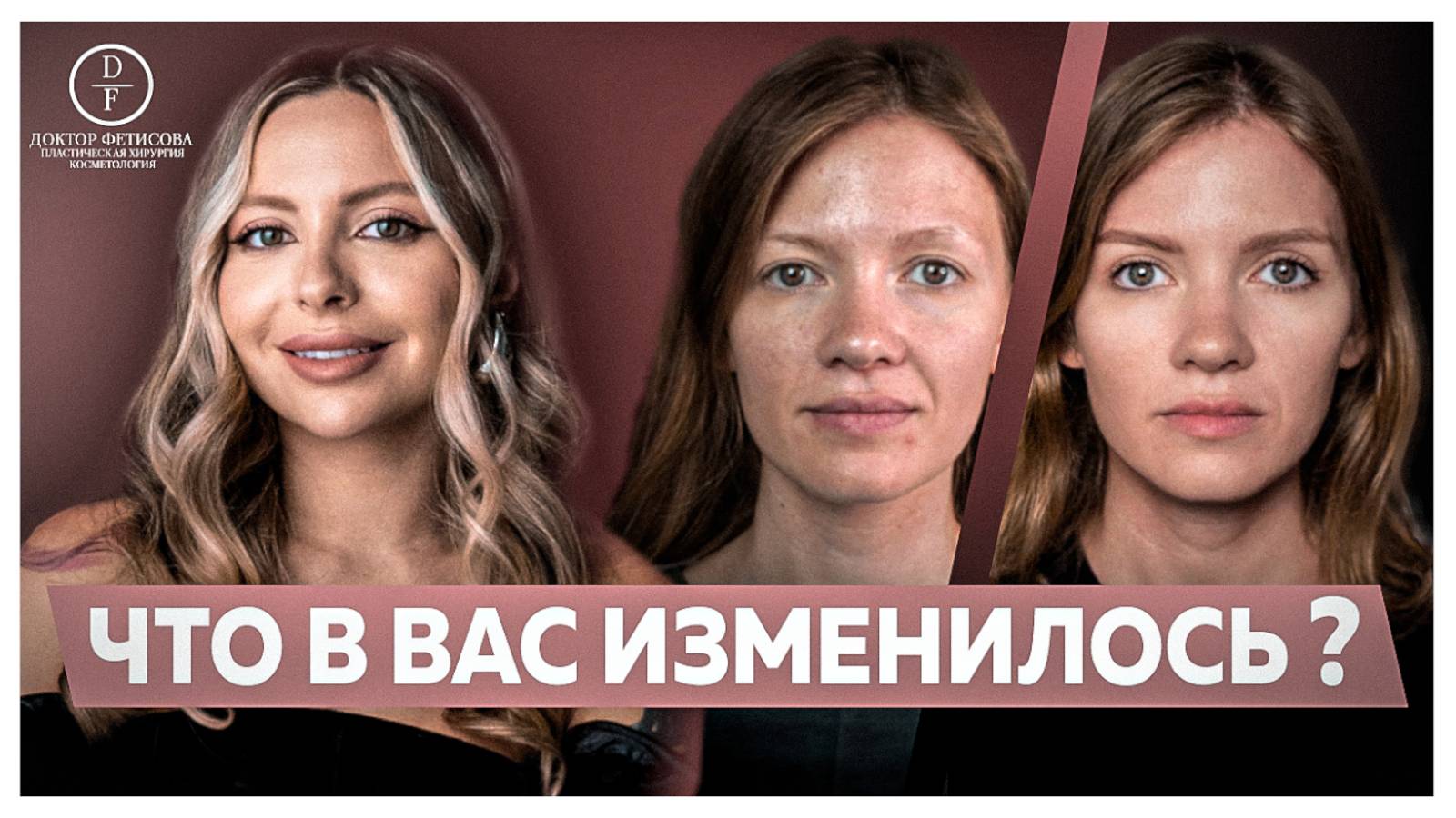 ЧТО В ВАС ИЗМЕНИЛОСЬ ❓