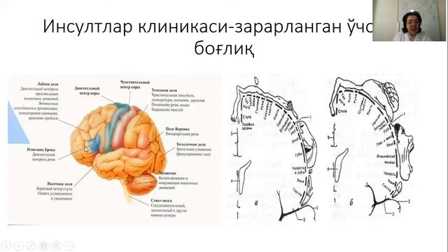Расулова Д.К Инсультлар 1-қисм