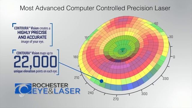 Best LASIK Technology Rochester NY