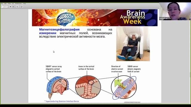 Открытая лекция Методы исследования мозга