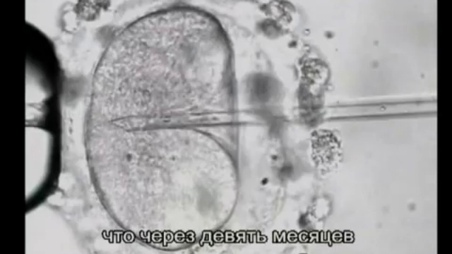 Лечение бесплодия в Израиле - медицинский центр Хадасса