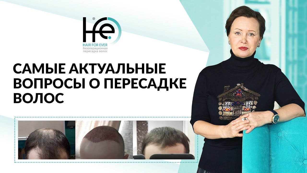 Топ-5 вопросов перед пересадкой волос | HFE Clinic 6+