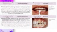 Лекция по фото. Эстетическая стоматология. Кафедра клинической стоматологии. 4 курс