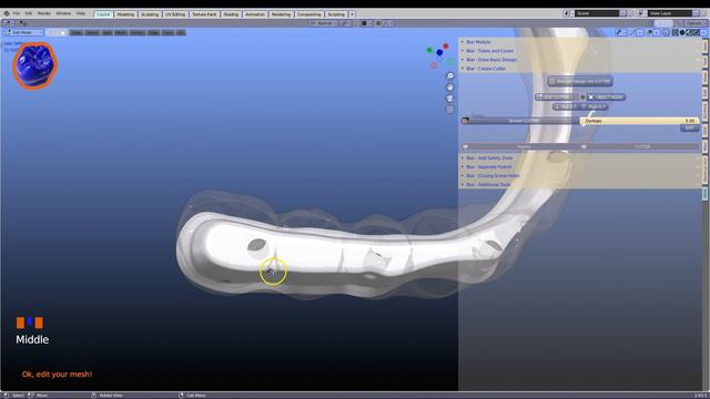 Программное обеспечение CAD для стоматологии — видео с описанием iBar