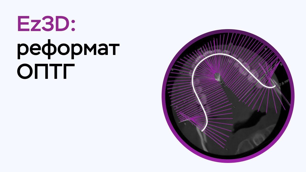 Возможности программы Ez3D: реформат ОПТГ