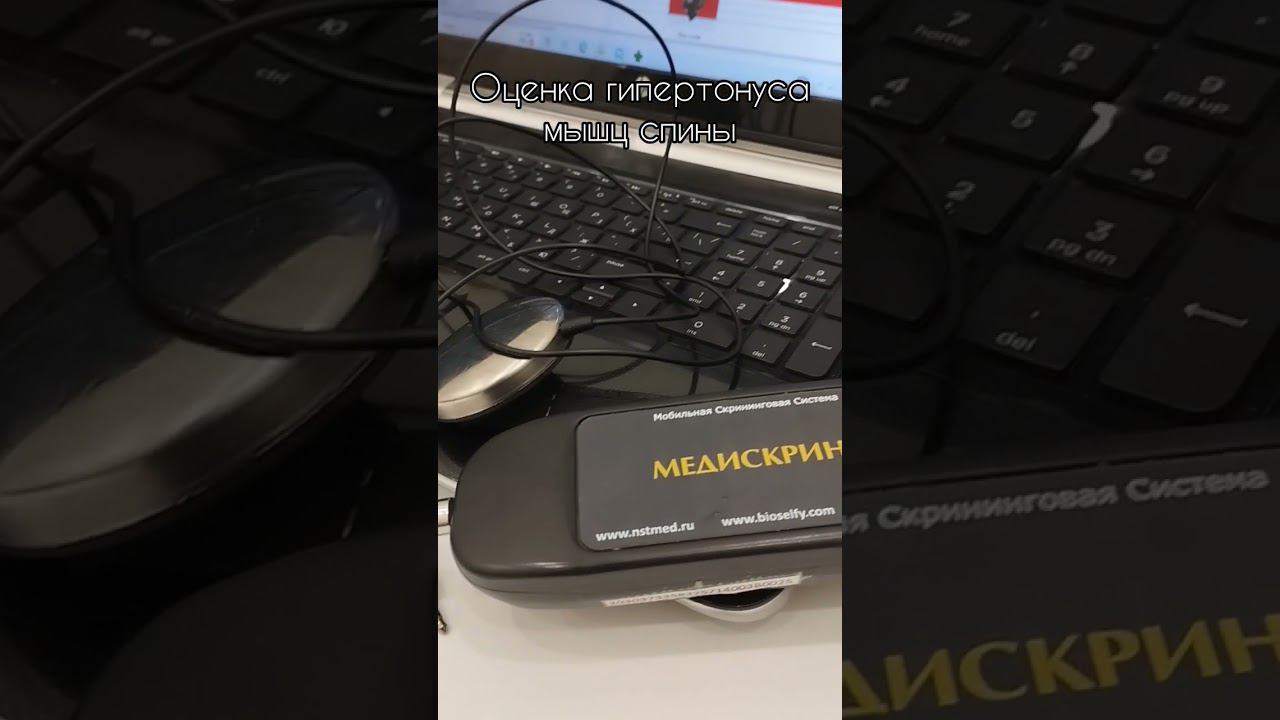 МЕТОД ОЦЕНКИ ФУНКЦИОНАЛЬНОГО СОСТОЯНИЯ МЫШЦ