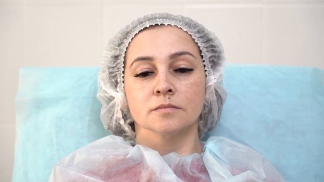 Коррекция губ препаратом гиалуроновой кислоты  Цель естественность и пропорциональность