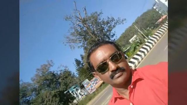 Crohns disease - inflammatory bowel disease