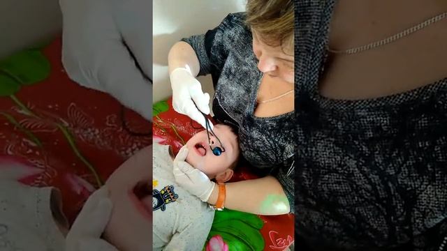 Логопедический массаж в Кеше 8(3462) 797577