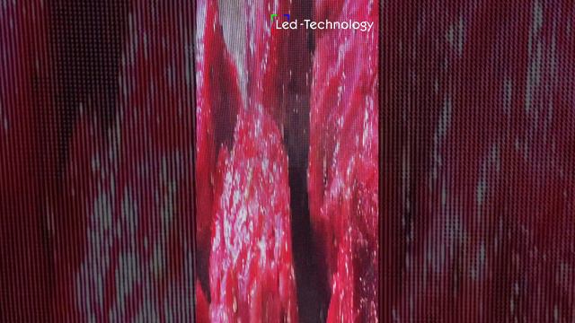 Наш новый продукт - led-постер 📺 #ledtechnology #led #ледэкран #screen #ледтехнолоджи #ledscreen