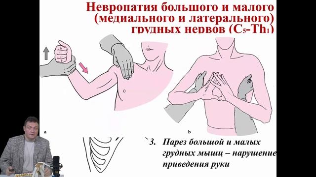 Дискуссионный клуб Боль в плече: Лечить...Нельзя...Оперировать