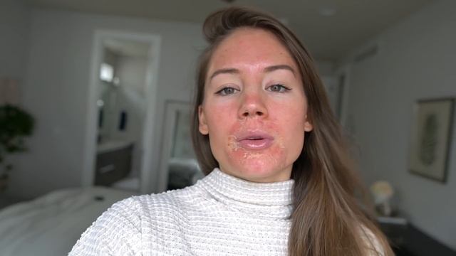 I DID A CHEMICAL PEEL  MICRONEEDLING