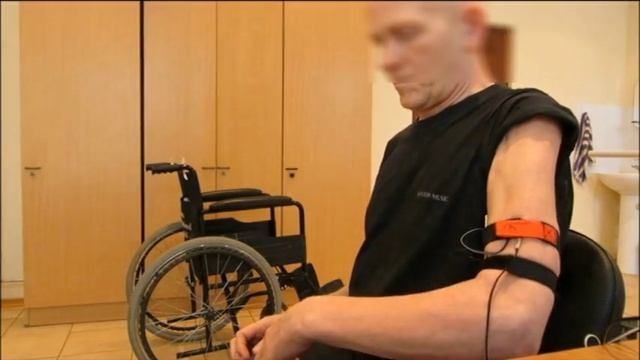 Инсульт Реабилитация Сроки реабилитации Пациент Г. 62 года
